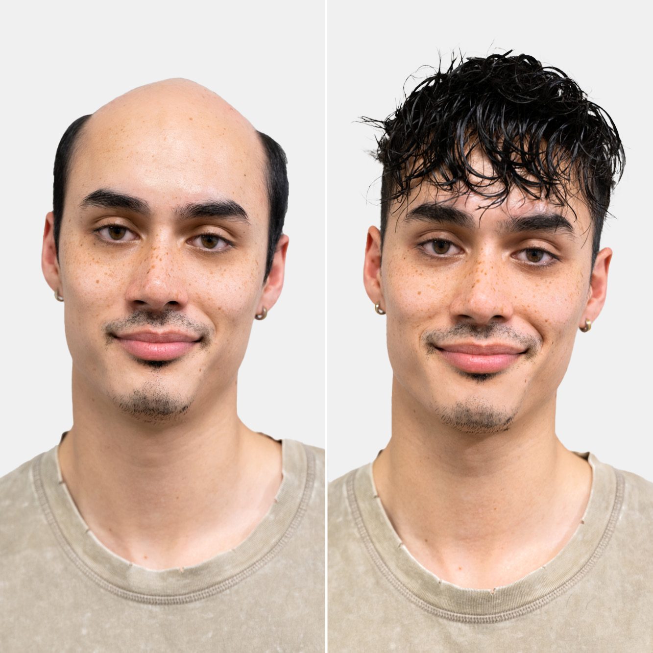 Hair Replacement System for boys