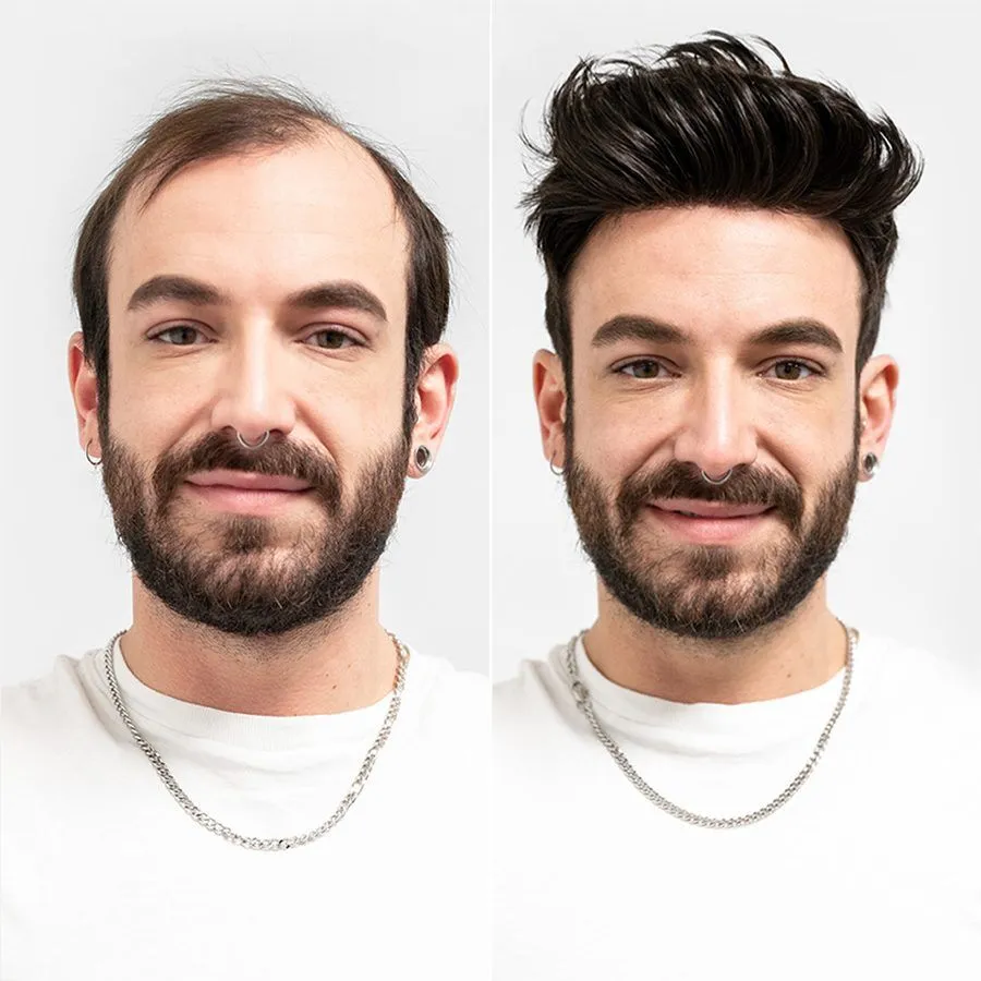 Hair Replacement System for boys