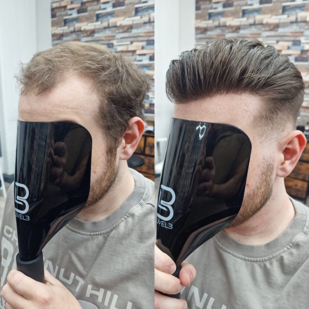 Hair system client result 10, London Hair Replacement