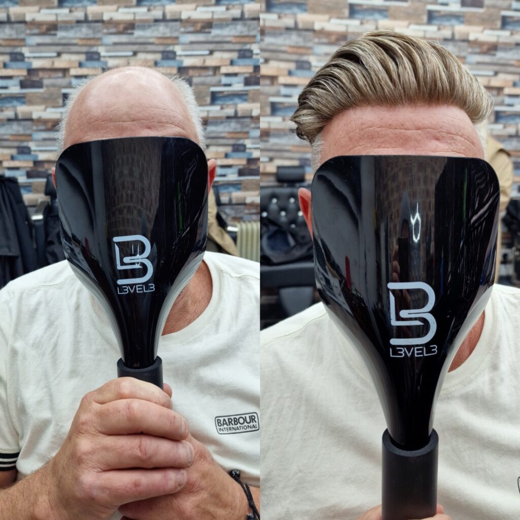 Hair system client result 12, London Hair Replacement