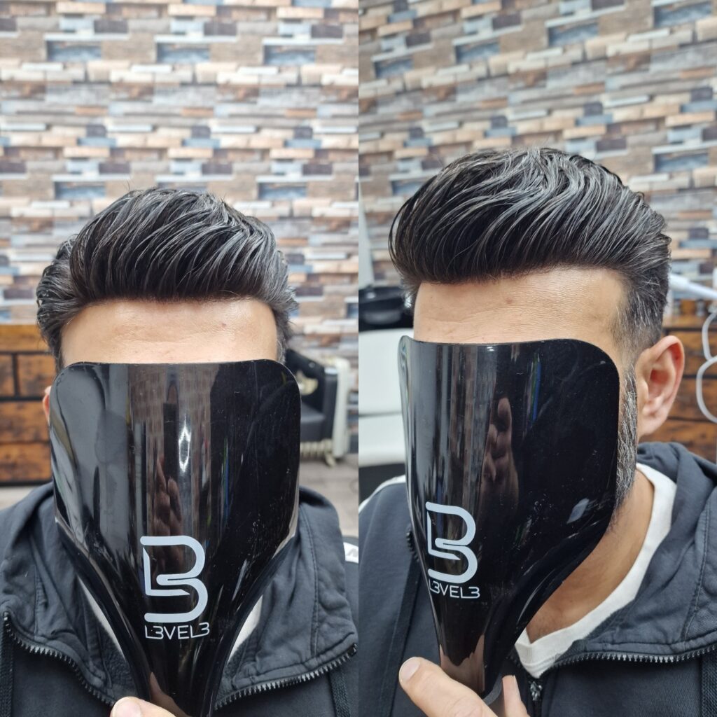 Hair system client result 13, London Hair Replacement