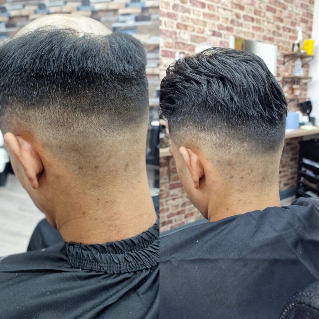 Hair system client result 18, London Hair Replacement