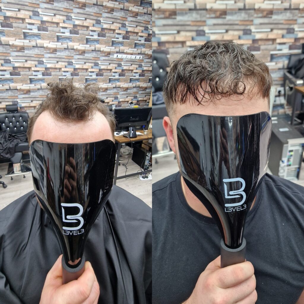 Hair system client result 20, London Hair Replacement