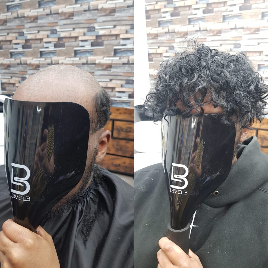 Hair system client result 21, London Hair Replacement