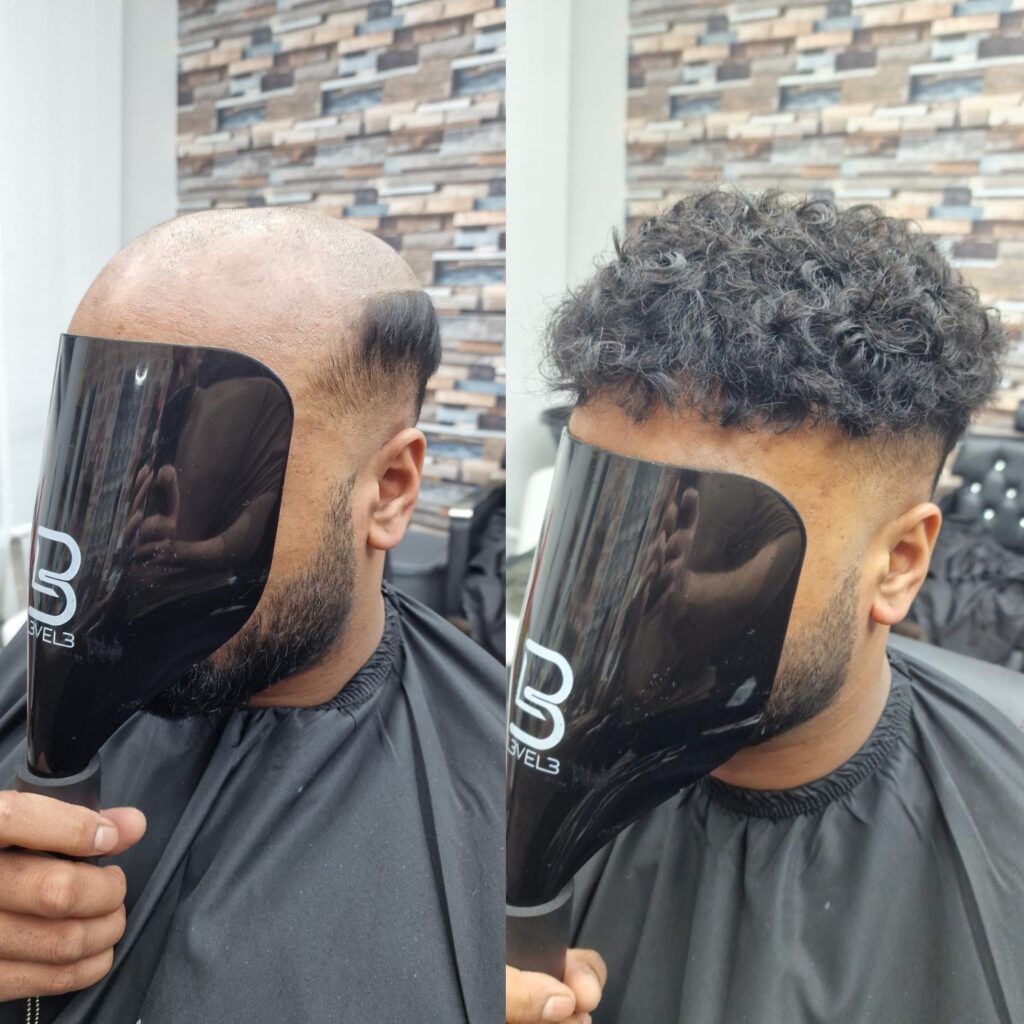 Hair system client result 22, London Hair Replacement