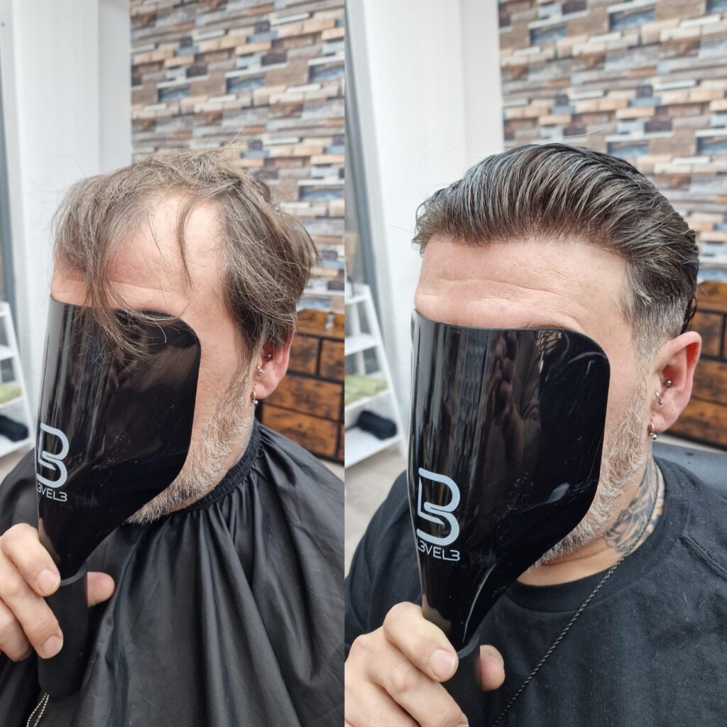 Hair system client result 5, London Hair Replacement