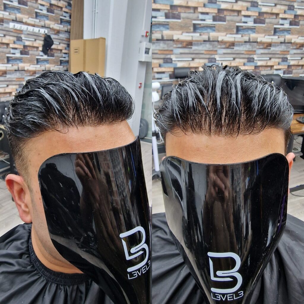 Hair system client result 6, London Hair Replacement