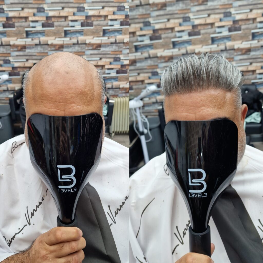 Hair system client result 7, London Hair Replacement